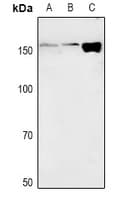 BIRC1 / NAIP Antibody