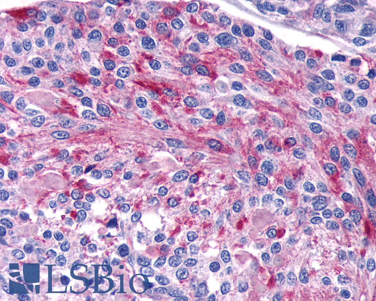 PathPlus™ Polyclonal Rabbit anti-Human CASR/Calcium Sensing Receptor Antibody (N-Terminus, IHC)