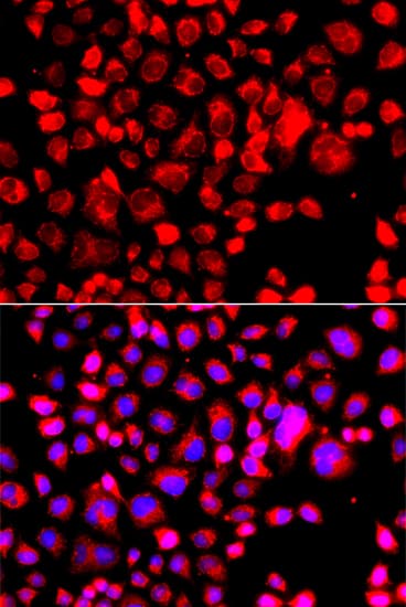 CCL11 / Eotaxin Antibody