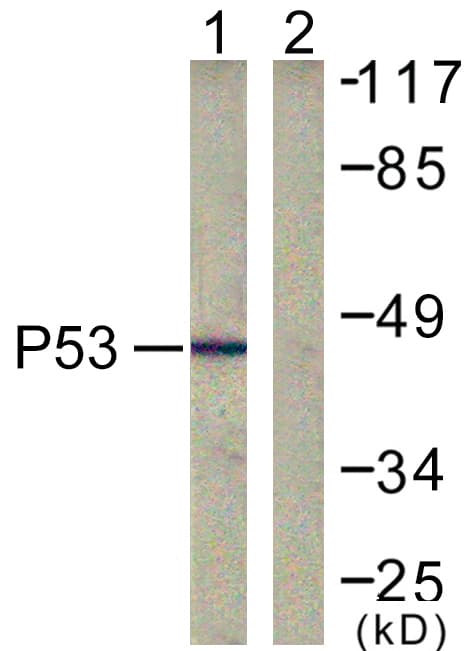 PathPlus™ TP53 / p53 Antibody (aa283-332)