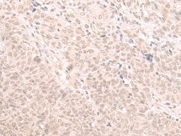 Polyclonal Rabbit anti-Human HOOK2 Antibody (IHC)