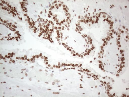 Monoclonal Mouse anti-Human HNRNPL / hnRNP L Antibody (clone OTI4E5, aa270-502, IHC)