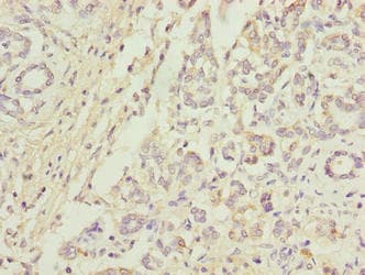 Polyclonal Rabbit anti-Human ANAPC5 / APC5 Antibody (IHC, WB)