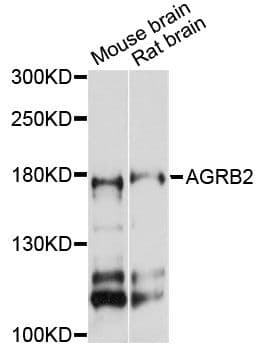 ADGRB2 / BAI2 Antibody
