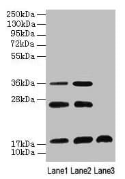 Polyclonal Rabbit anti-Human SFT2D2 Antibody