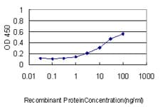 IHC-plus™ YBX1 / YB1 Antibody (clone 4F12)
