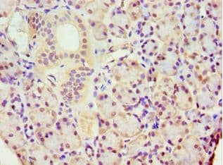ACTR3B / ARP4 Antibody (aa189-418)