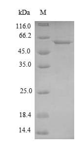 Mycoplasma pneumoniae pepA Protein (Recombinant 6His-SUMO, N-terminus)