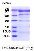Human OXSR1 / OSR1 Protein (Recombinant His)