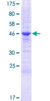 Human ZCCHC10 Protein (Recombinant GST)