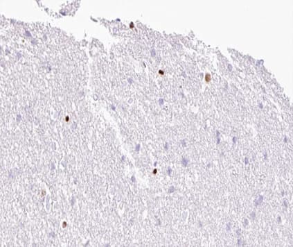 MOK / RAGE Antibody