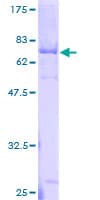 Human NOTUM Protein (Recombinant GST)