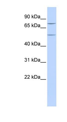 ZNF582 Antibody (aa72-121)