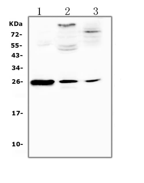 CRP / C-Reactive Protein Antibody