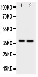 MCL1 / MCL 1 Antibody (aa303-325)