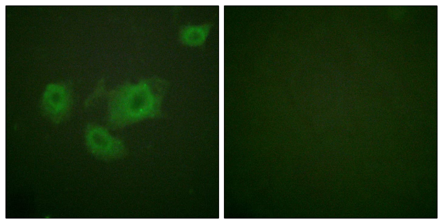 KCNJ11 / Kir6.2 Antibody (phospho-Thr224)