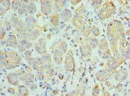 CCL28 / MEC Antibody (aa20-127)