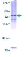 Human ASB1 Protein (Recombinant GST)