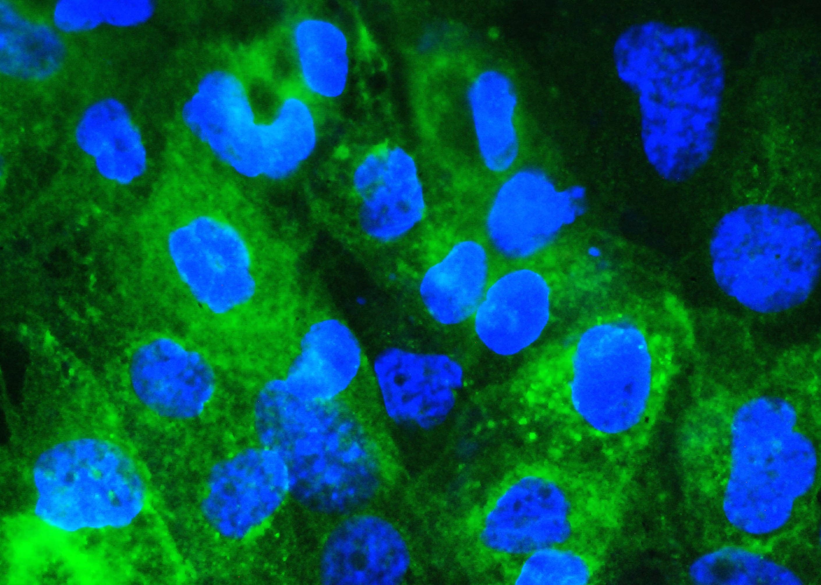 Polyclonal Rabbit anti-Human B2M / Beta 2 Microglobulin Antibody (IHC, WB)