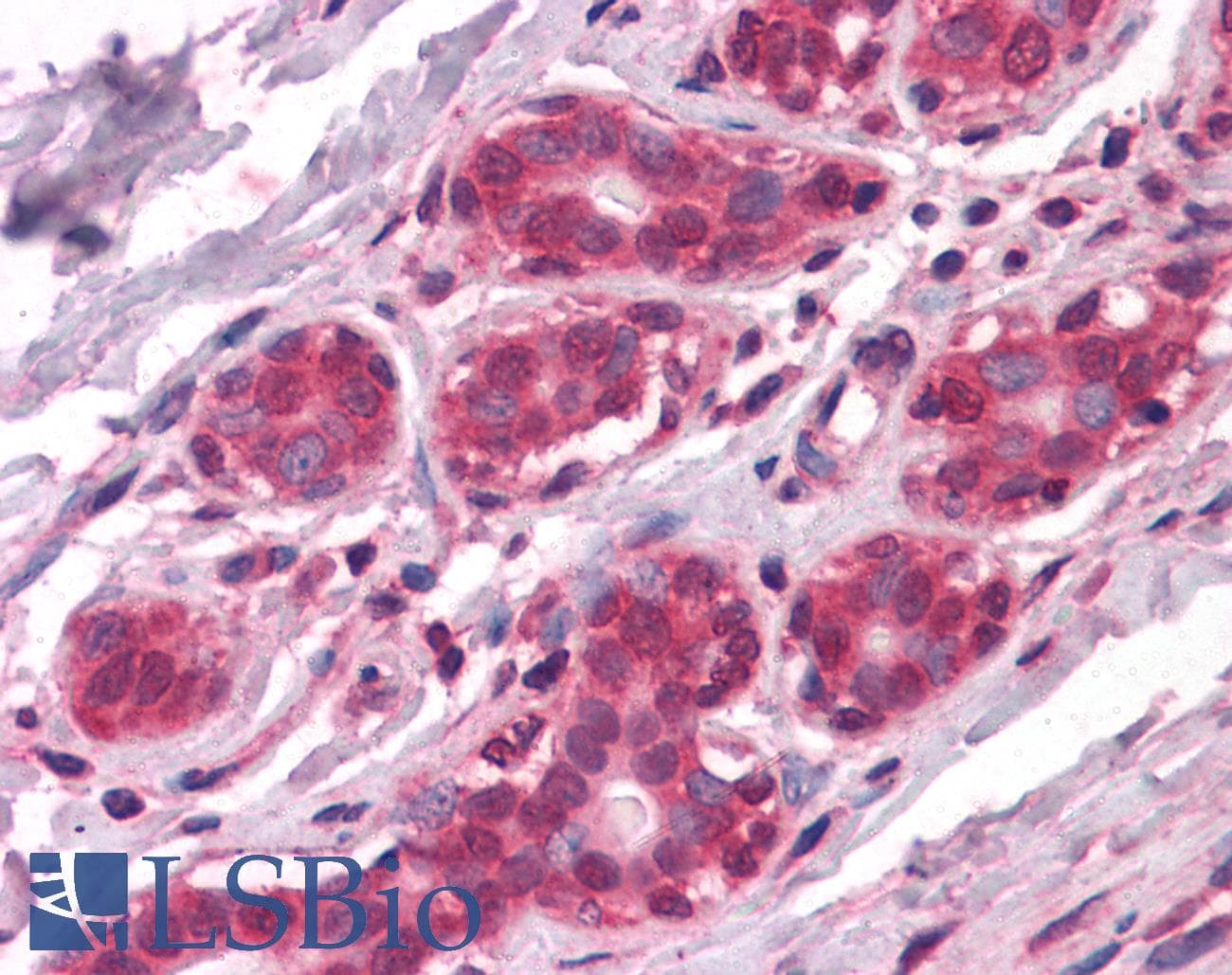 IHC-plus™ NME1 / NM23 Antibody (clone 4B2)