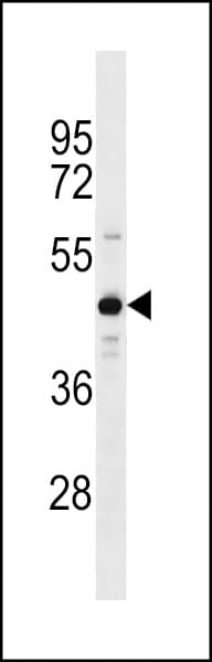 Polyclonal Rabbit anti-Human ZNF883 Antibody (aa155-181, WB)