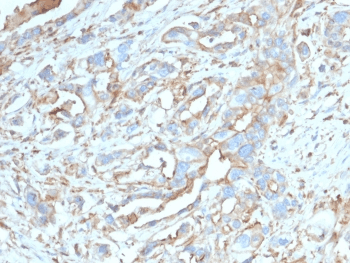 Monoclonal Mouse anti-Human CD274 / B7-H1 / PD-L1 Antibody (clone PDL1/2746, IHC, IF, WB)