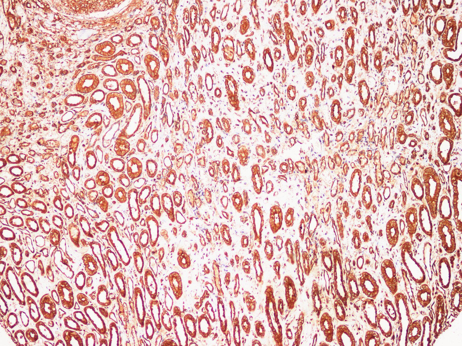 S100A9 / MRP14 Antibody