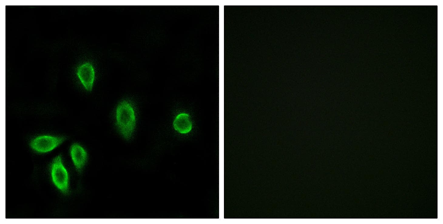 Polyclonal Rabbit anti-Human TRH Receptor / TRHR Antibody (IF, WB)