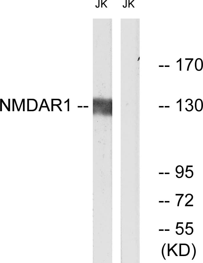 Polyclonal Rabbit anti-Human GRIN1 / NMDAR1 Antibody (aa856-905, IHC, IF, WB)