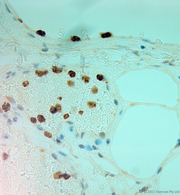 MPO / Myeloperoxidase Antibody