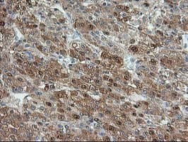 ACY1 / Aminoacylase 1 Antibody (clone OTI1A12)