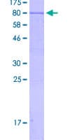 Human KRT75 / Keratin 75 / K6HF Protein (Recombinant GST, N-terminus)