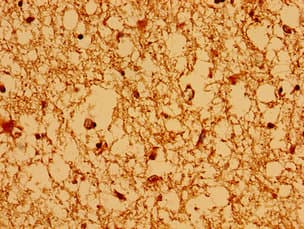 Polyclonal Rabbit anti-Human AXIN2 / Axin 2 Antibody (IHC)