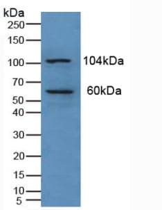 PKN1 Antibody (aa615-874)
