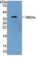 FLT1 / VEGFR1 Antibody (aa18-308)