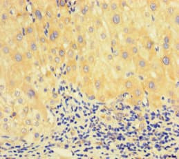 RAD51 / RECA Antibody