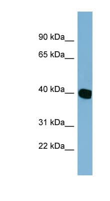 NOXRED1 / C14orf148 Antibody (aa179-228)