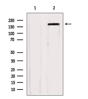 KIAA0191 / ZCCHC11 Antibody