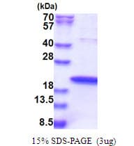Human ZNHIT1 Protein (Recombinant His)
