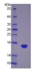 Human TGFB4 / LEFTY2 Protein (Recombinant His)