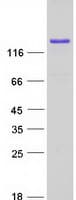 Human FKBP15 Protein (Recombinant Myc-DDK (Flag))