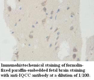 IQCC Antibody (aa5-170)