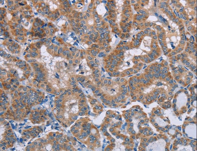 Polyclonal Rabbit anti-Human POMT1 Antibody (IHC, WB)