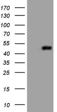 REN / Renin 1 Antibody (aa131-406, clone OTI2B2)