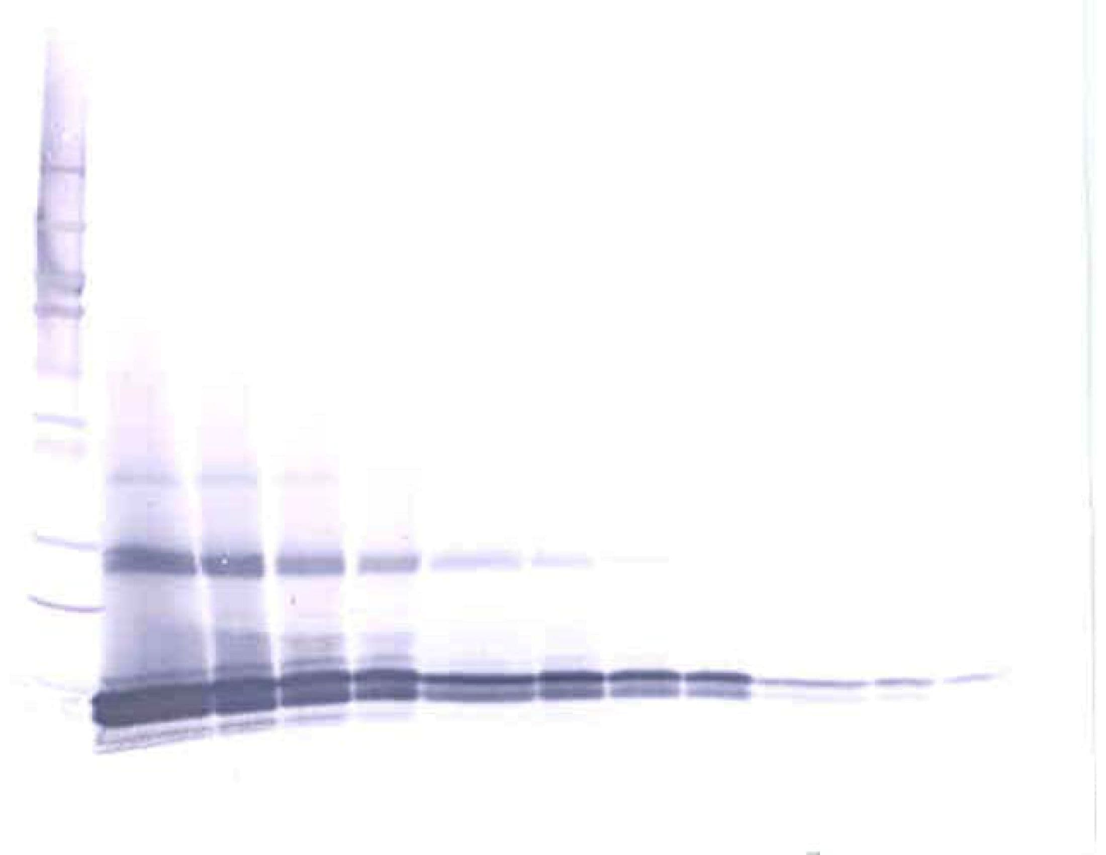 GDF3 Antibody