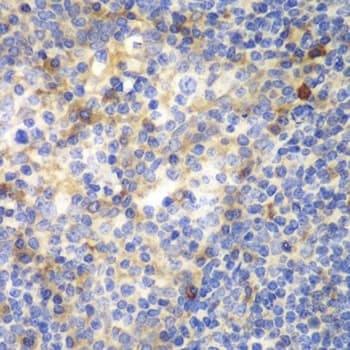 ZAP70 Antibody
