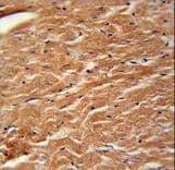 Polyclonal Rabbit anti-Human COPZ2 Antibody (aa156-184, IHC, WB)