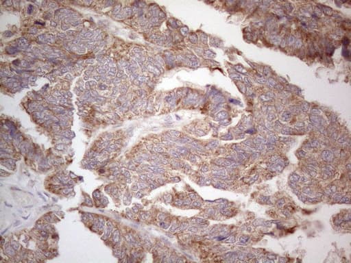 ABCC5 / MRP5 Antibody (clone OTI2C8)