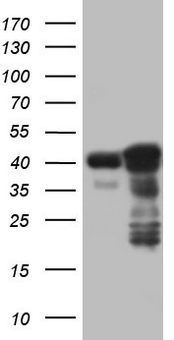 Monoclonal Mouse anti-Human TP53 / p53 Antibody (clone OTI7A11, IHC, WB)