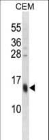 SPRR3 Antibody (aa101-129)